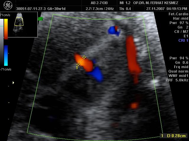 Ultrason Ölçümleri